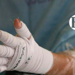 Dos quemados por pólvora en Andes y Amagá