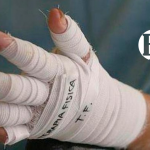 Niño de 9 años resultó quemado con pólvora en Ciudad Bolívar