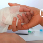 Ya son cuatro quemados por pólvora en el Suroeste