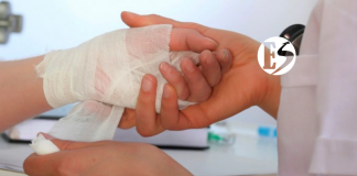 Ya son cuatro quemados por pólvora en el Suroeste